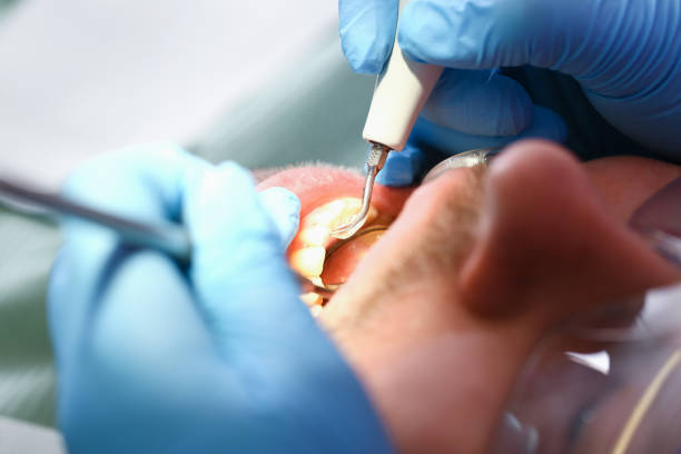Best Dentist Open Late Near Me  in Hudson Lake, IN